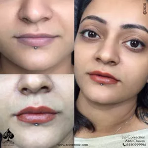 Best Lip Blush Treatment in Mumbai